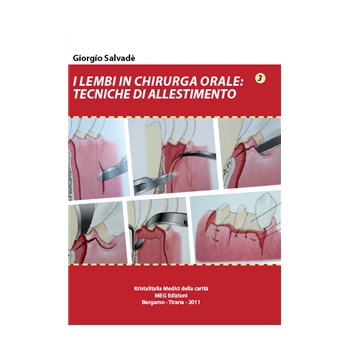 I Lembi in Chirurgia Orale - Tecniche di Allestimento I Lembi in Chirurgia Orale - Tecniche di Allestimento