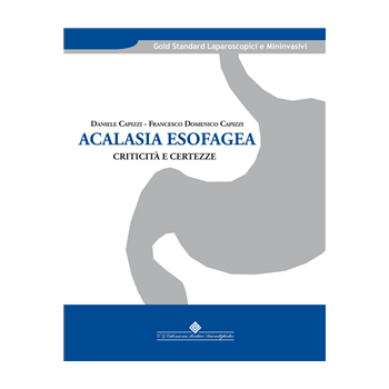 Acalasia esofagea